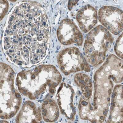 Immunohistochemistry-Paraffin: FAM73A Antibody [NBP1-93832]