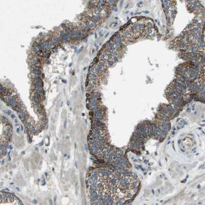 Immunohistochemistry-Paraffin: FAM73A Antibody [NBP1-93832]