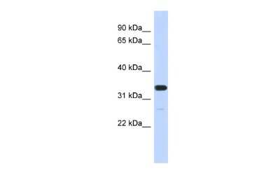 Western Blot: FAM76A Antibody [NBP3-09312]