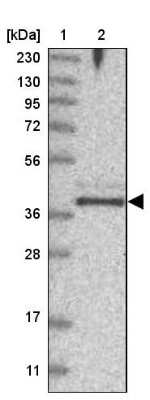 Western Blot: FAM76B Antibody [NBP2-32670]