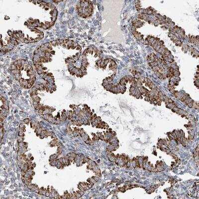 Immunohistochemistry: FAM78A Antibody [NBP1-86699]