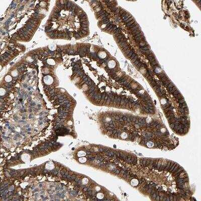 Immunohistochemistry: FAM78A Antibody [NBP1-86700]