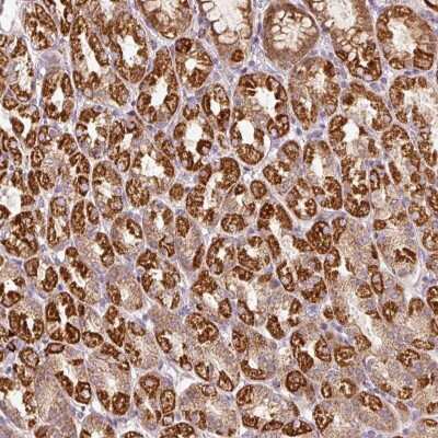 Immunohistochemistry: FAM78B Antibody [NBP2-49061]