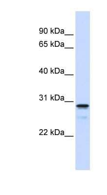 Western Blot: FAM78B Antibody [NBP1-55527]