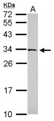 Western Blot: FAM78B Antibody [NBP2-16422]