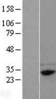 Western Blot: FAM78B Overexpression Lysate [NBL1-10567]