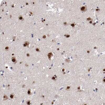 Immunohistochemistry-Paraffin: FAM81A Antibody [NBP2-33295]