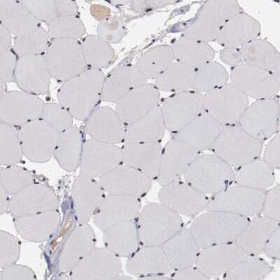 Immunohistochemistry-Paraffin: FAM81A Antibody [NBP2-33295]