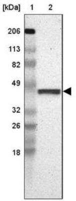Western Blot: FAM81A Antibody [NBP2-33295]