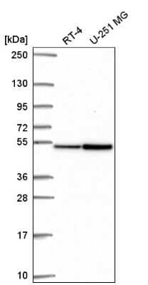 Western Blot: FAM81A Antibody [NBP2-56437]