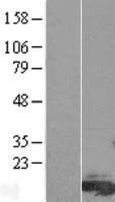 Western Blot: FAM81A Overexpression Lysate [NBP2-05352]