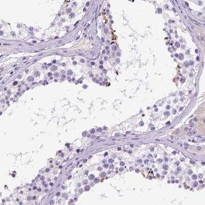 Immunohistochemistry: FAM81B Antibody [NBP2-49677]