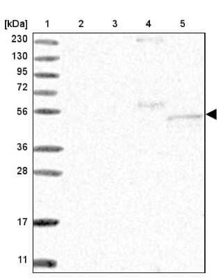 Western Blot: FAM82A Antibody [NBP2-38216]