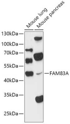 Western Blot: FAM83A AntibodyAzide and BSA Free [NBP3-04461]