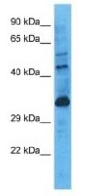 Western Blot: FAM83A Antibody [NBP3-09711]