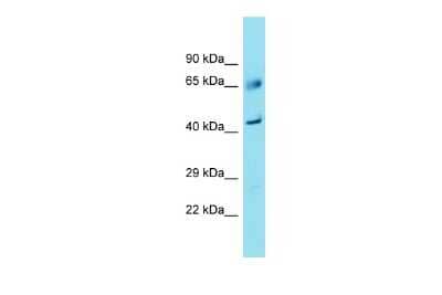 Western Blot: FAM83A Antibody [NBP3-09712]