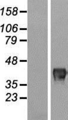 Western Blot: FAM83A Overexpression Lysate [NBL1-10573]