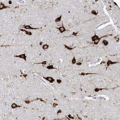 Immunohistochemistry: FAM83B Antibody [NBP1-86763]