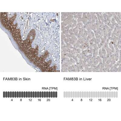 Immunohistochemistry-Paraffin: FAM83B Antibody [NBP1-86764]