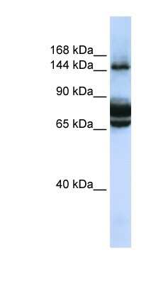 Western Blot: FAM83B Antibody [NBP1-79546]