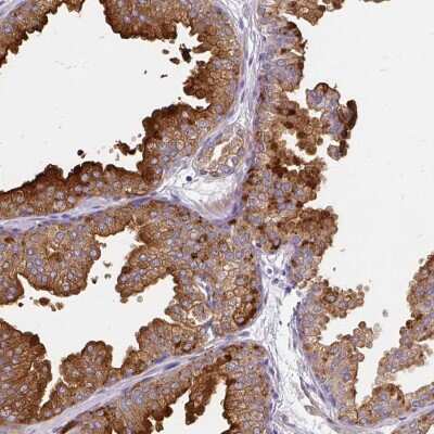 Immunohistochemistry: FAM83C Antibody [NBP2-37925]