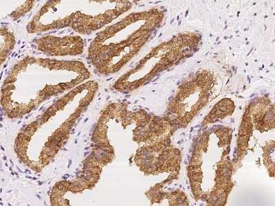 Immunohistochemistry-Paraffin: FAM83C Antibody [NBP2-98186]