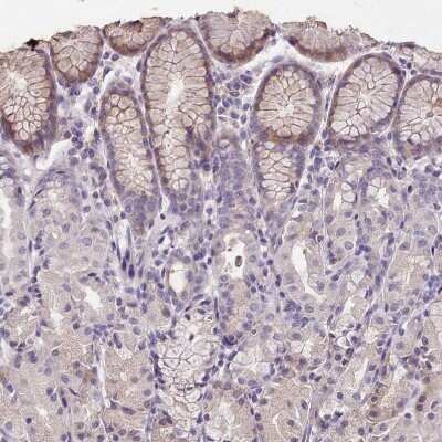 Immunohistochemistry-Paraffin: FAM83E Antibody [NBP2-14004]