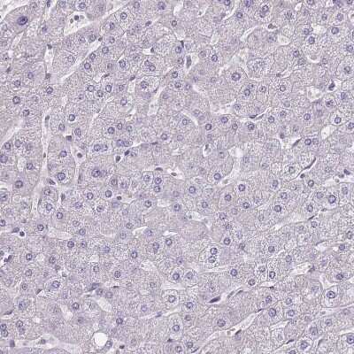 Immunohistochemistry-Paraffin: FAM83F Antibody [NBP2-14005]