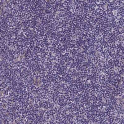 Immunohistochemistry-Paraffin: FAM83F Antibody [NBP2-14005]
