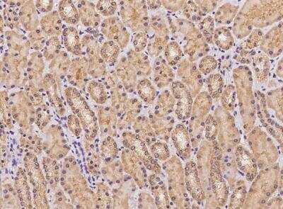 Immunohistochemistry-Paraffin: FAM83F Antibody [NBP3-05913]