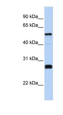 Western Blot: FAM83F Antibody [NBP1-79504]