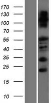 Western Blot: FAM83F Overexpression Lysate [NBP2-05672]