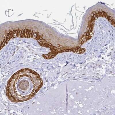 Immunohistochemistry-Paraffin: FAM83G Antibody [NBP1-93772]