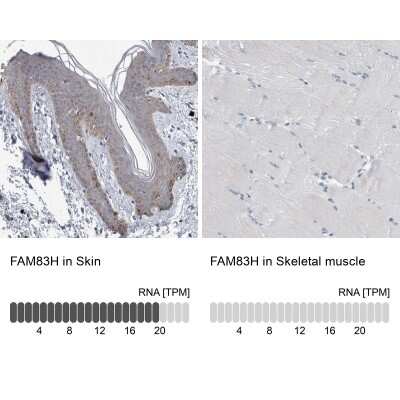 Immunohistochemistry-Paraffin: FAM83H Antibody [NBP1-93737]