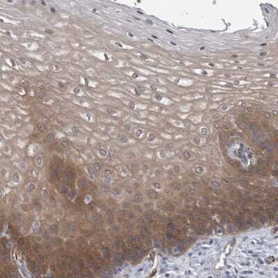 Immunohistochemistry-Paraffin: FAM83H Antibody [NBP1-93738]