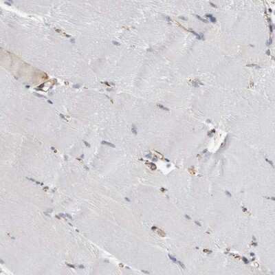 Immunohistochemistry-Paraffin: FAM83H Antibody [NBP1-93738]