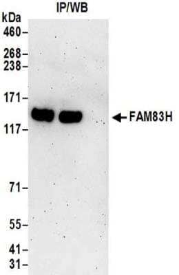 Immunoprecipitation: FAM83H Antibody [NBP2-32218]