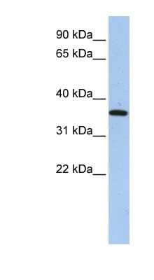 Western Blot: FAM84A Antibody [NBP1-56585]