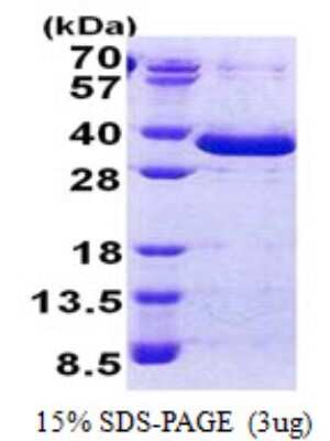 SDS-PAGE: Recombinant Human FAM84A His Protein [NBP2-23036]