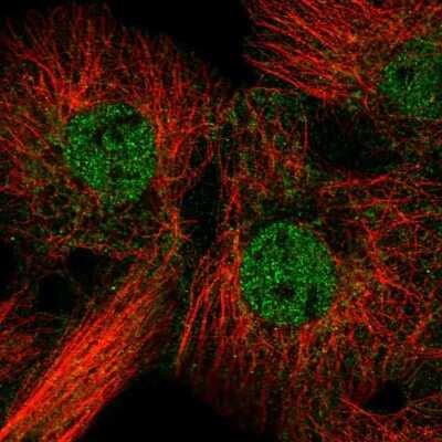 Immunocytochemistry/ Immunofluorescence: FAM84B Antibody [NBP2-57217]