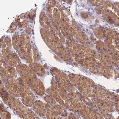 Immunohistochemistry-Paraffin: FAM84B Antibody [NBP2-47459]