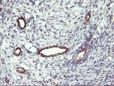 Immunohistochemistry: FAM84B Antibody (OTI1D12) - Azide and BSA Free [NBP2-72440]