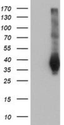 Western Blot: FAM84B Antibody (OTI1D12) [NBP2-03263]