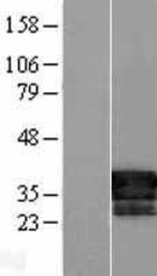 Western Blot: FAM84B Overexpression Lysate [NBL1-10577]