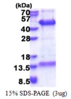 SDS-PAGE: Recombinant Human FAM84B His Protein [NBP2-23037]