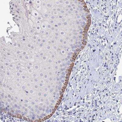 Immunohistochemistry: FAM86A Antibody [NBP2-14007]