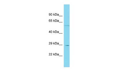 Western Blot: FAM86A Antibody [NBP2-82732]