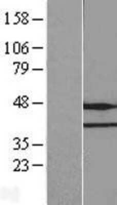 Western Blot: FAM86A Overexpression Lysate [NBL1-10578]