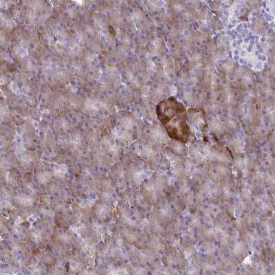 Immunohistochemistry: FAM86B1 Antibody [NBP2-49190]