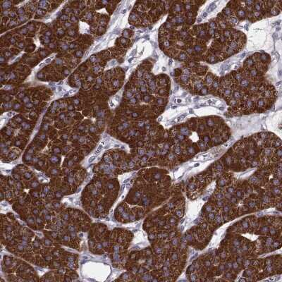 Immunohistochemistry: FAM8A1 Antibody [NBP2-68965]